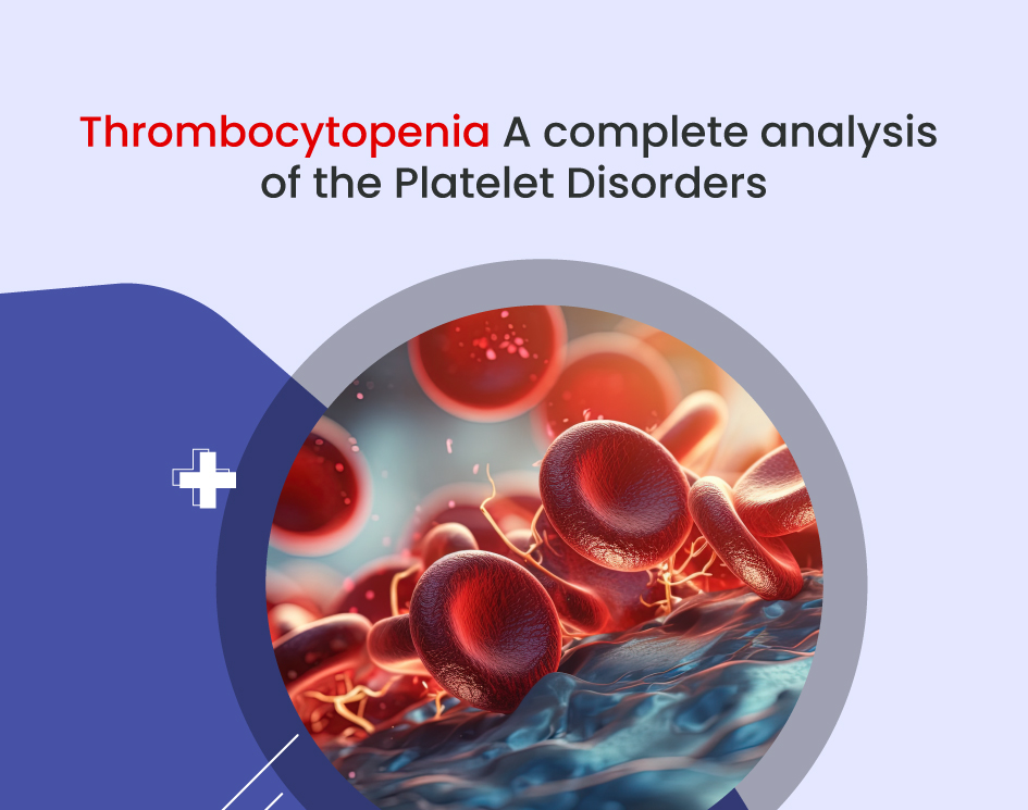 Thrombocytopenia: A Complete Analysis of the Platelet Disorders