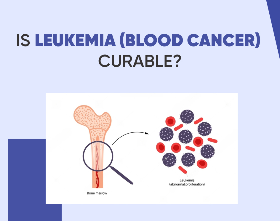 Is Leukemia (Blood Cancer) Curable?