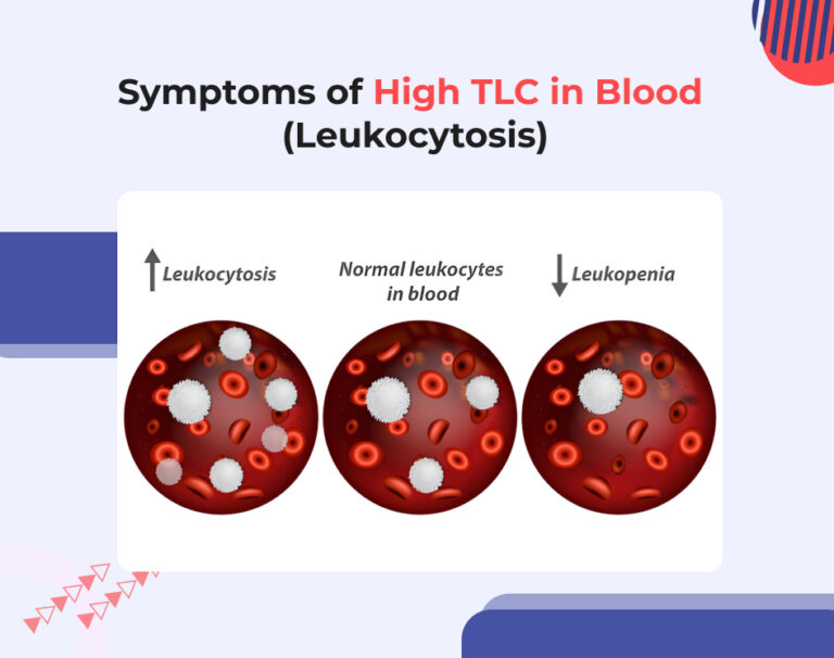 Symptoms of High TLC in Blood (Leukocytosis)