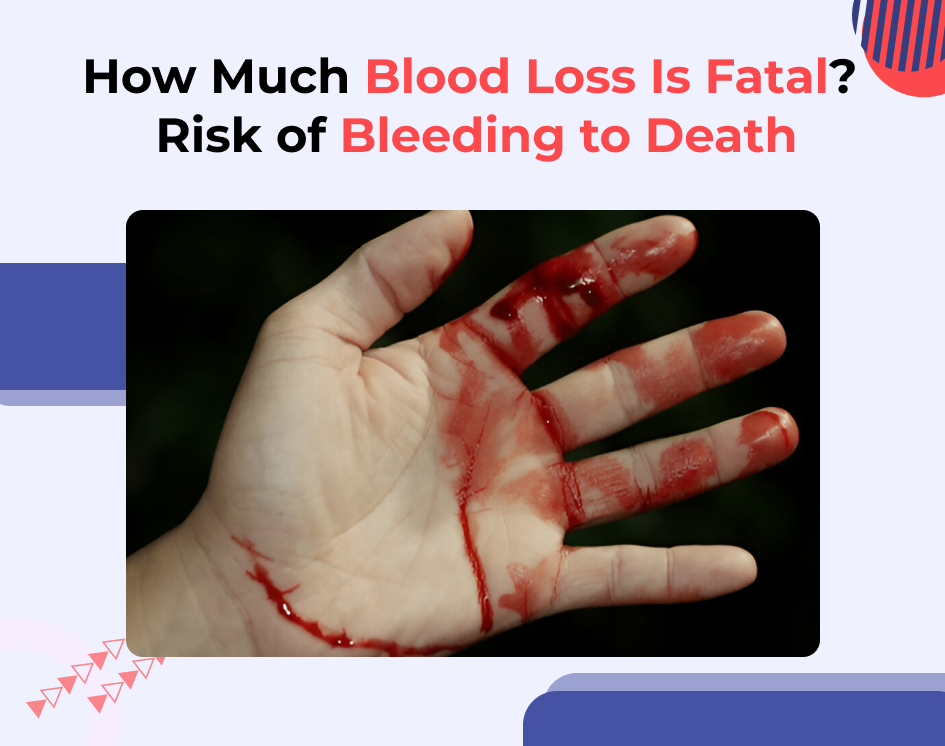How Much Blood Loss Is Fatal? Risk of Bleeding to Death
