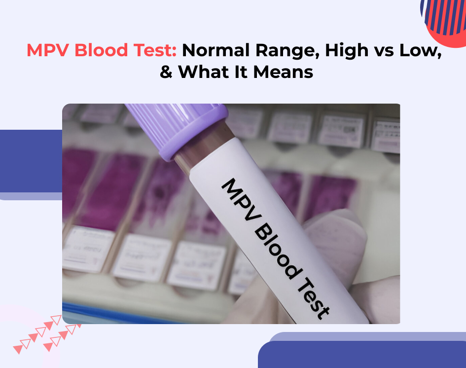 MPV Blood Test: Normal Range, High vs Low, and What It Means?