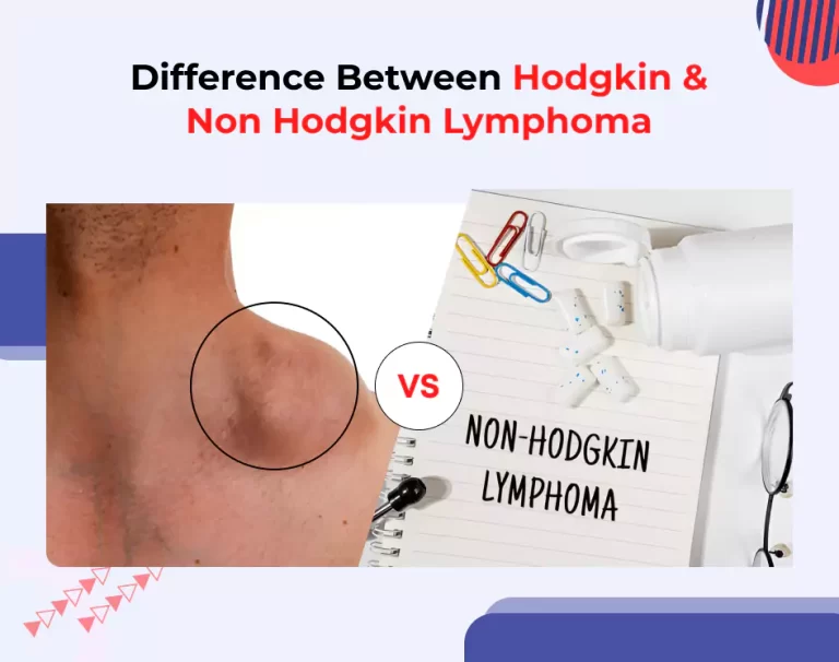 Difference Between Hodgkin and Non Hodgkin Lymphoma