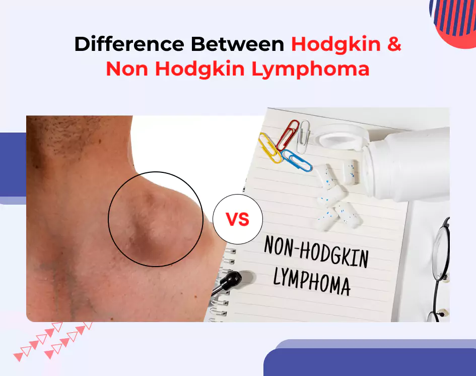 Difference Between Hodgkin & Non Hodgkin Lymphoma