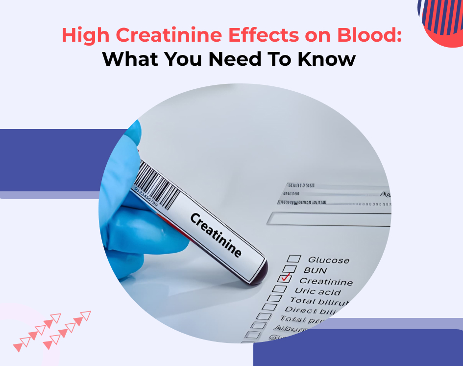 High Creatinine Effects on Blood: What You Need To Know 