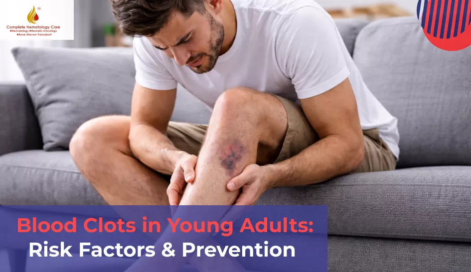 Blood Clots in Young Adults: Risk Factors & Prevention 