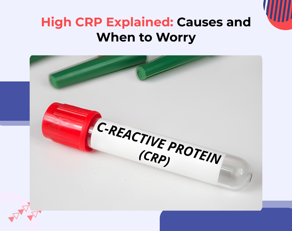 High CRP (c-reactive protein): What does an elevated result really mean?