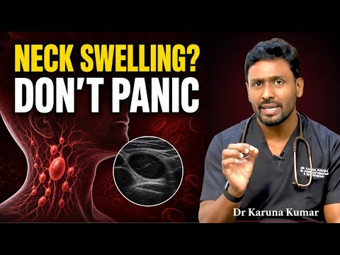 Neck Swelling: Infection or Cancer? When to Worry