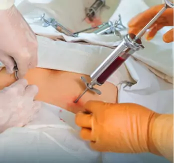 Bone Marrow Transplant & Stem cells