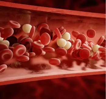 Coagulation Disorder